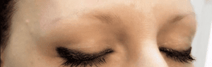 How to cope with hair loss - what are the options? * How-to-cope-with-hair-loss-what-are-the-options_www.lisasnotebook.com