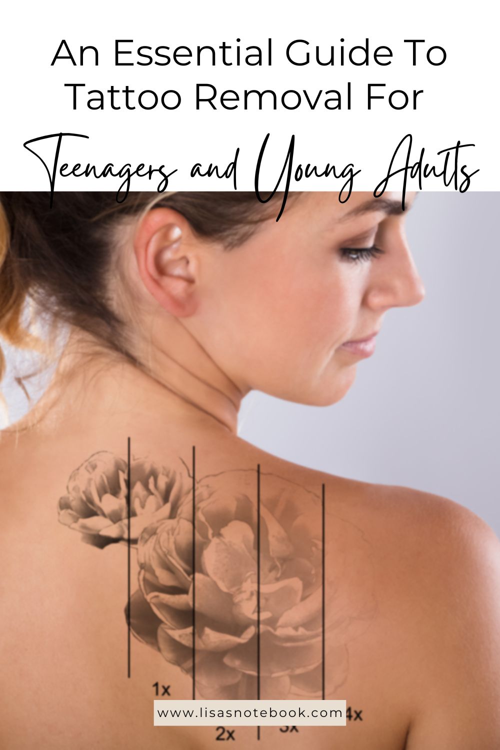 Tattoo Removal for Teenagers and Young Adults * tattoo-removal-for-teenagers-young-adults-pinterest